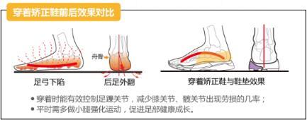 愛矯健護(hù)足課堂:扁平足要注意科學(xué)選鞋
